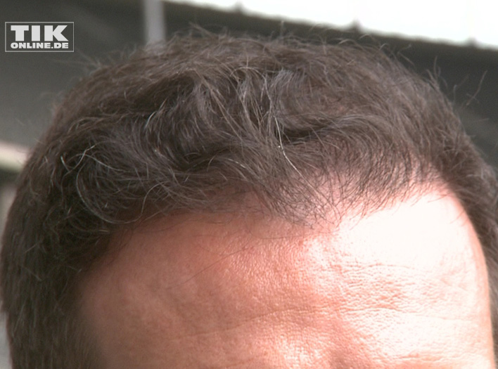 Christoph Metzelder und seine Haare