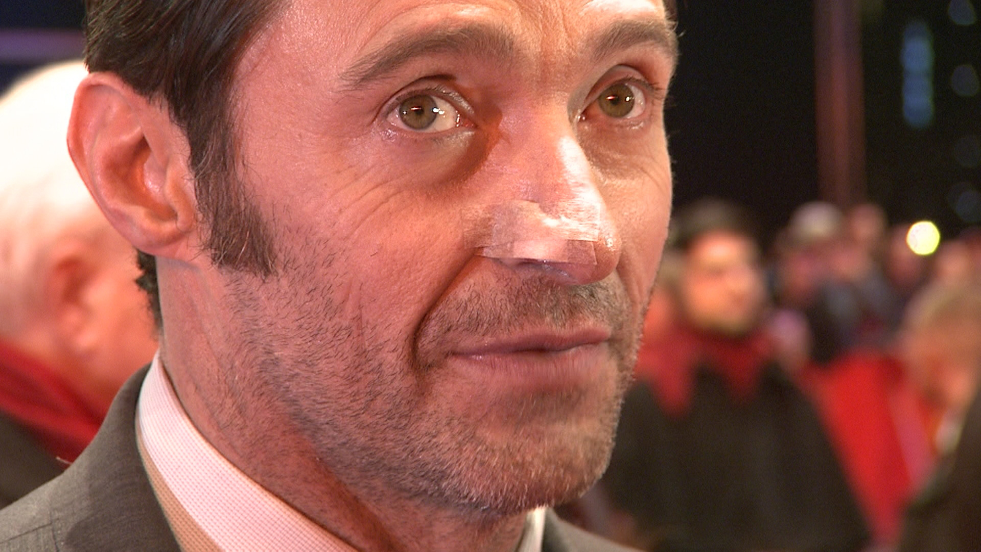 Hugh Jackman über seinen Hautkrebs: „Logan“-Weltpremiere mit Pflaster in Berlin